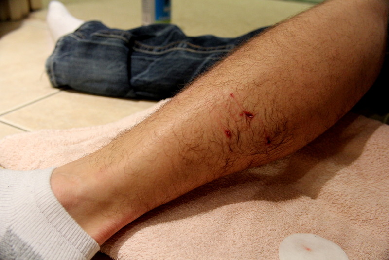Professional Glendale Dog Bite Injury Attorney Professional Glendale Dog Bite Injury Attorney
