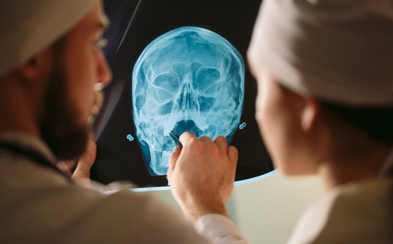 best brain injury lawyer in Glendale